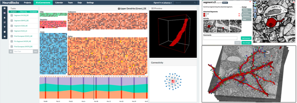 NeuroBlocks segmentation tracking.